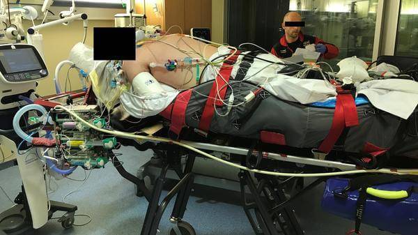 prone position patient ARDS ECMO transfer 3