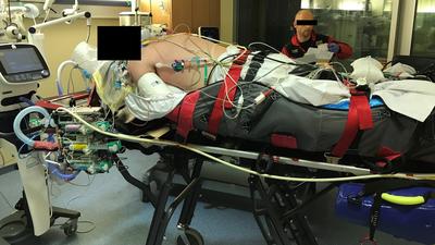 prone position patient ARDS ECMO transfer 3