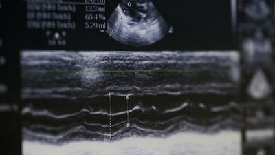 ultrasound